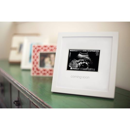 Pearhead Photo frame for ultrasound picture - Coming Soon - White